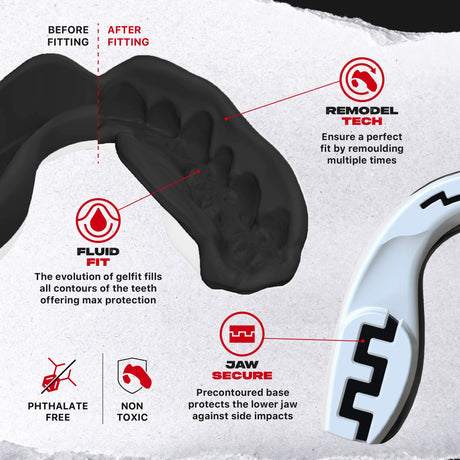 Black/White SAFEJAWZ Extro Series Skull Mouthguard - view 3