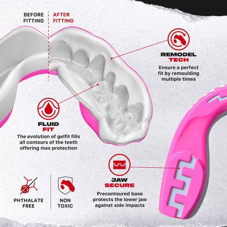 SAFEJAWZ Extro Series Pink Viper Mouthguard - view 3